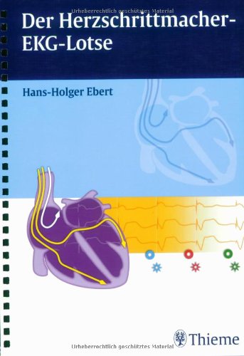 Der Herzschrittmacher-EKG-Lotse Medicine