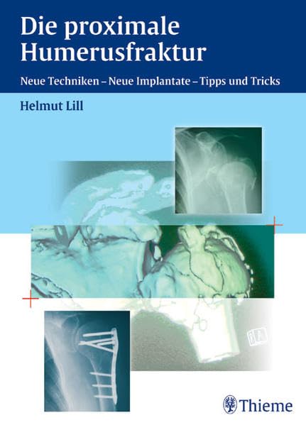 Die Proximale Humerusfraktur: Neue Techniken, neue Implantate - Tipps und Tricks Medicine