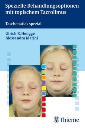 Spezielle Behandlungsoptionen mit topischem Tacrolimus: Taschenatlas spezial Medicine
