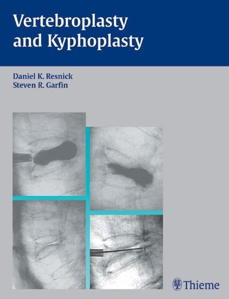 Vertebroplasty and Kyphoplasty (American Association of Neurological Surgeons) Medicine