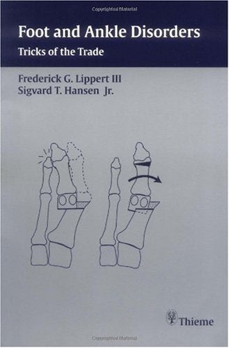 Foot and Ankle Disorders: Tricks of the Trade Medicine