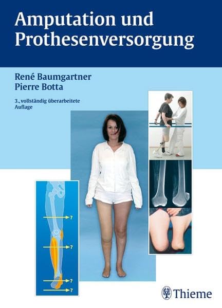 Amputation und Prothesenversorgung Medicine