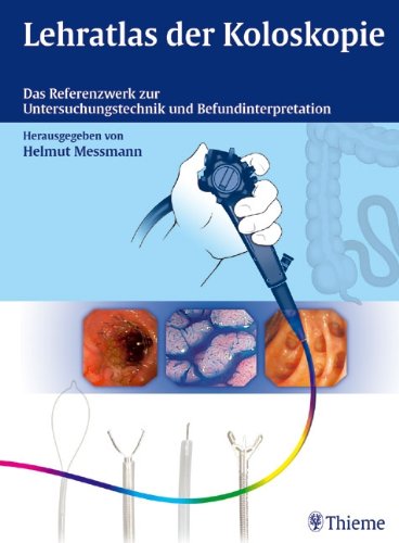 Lehratlas der Koloskopie: Das Referenzwerk zur Untersuchungstechnik und Befundinterpretation Medicine