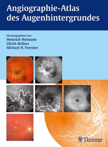 Angiographie-Atlas des Augenhintergrundes Medicine