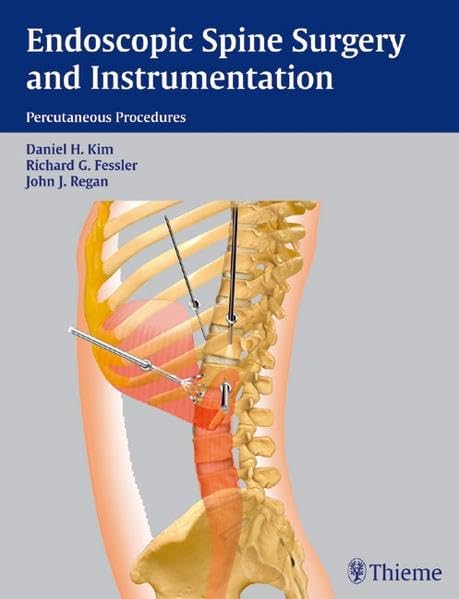 Endoscopic Spine Surgery and Instrumentation: Percutaneous Procedures Medicine