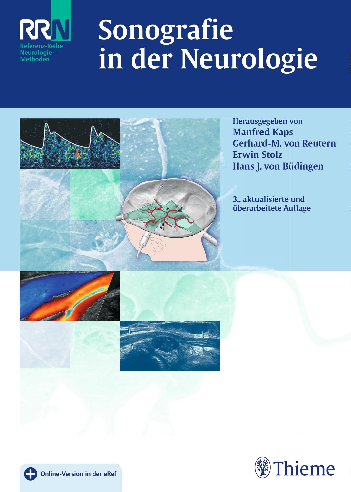 Sonografie in der Neurologie Medicine