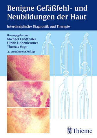 Benigne Gefässfehl- und Neubildungen der Haut: Interdisziplinäre Diagnostik und Therapie Medicine