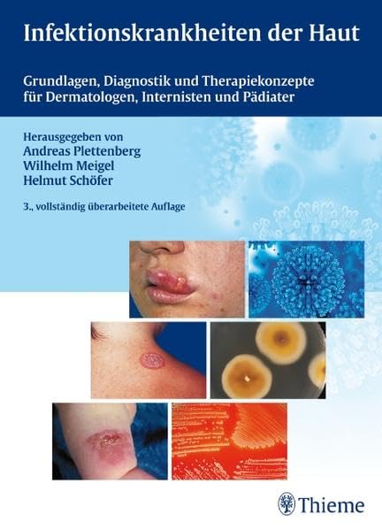 Infektionskrankheiten der Haut: Grundlagen, Diagnostik, Therapiekonzepte f. Dermatologen, Internisten u Pädiater: Grundlagen, Diagnostik und Therapiekonzepte für Dermatologen, Internisten und Pädiater Medicine