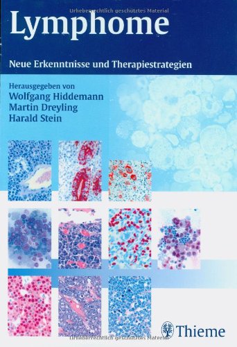 Lymphome: Neue Erkenntnisse und Therapiestrategien Medicine