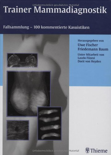 Trainer Mammadiagnostik: Fallsammlung - 100 kommentierte Kasuistiken Medicine