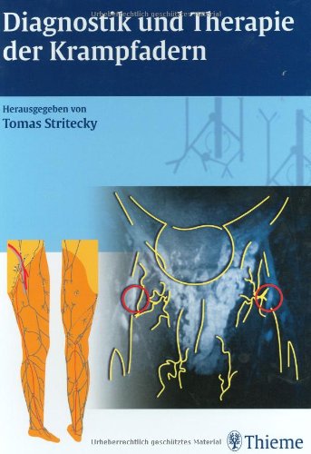Diagnostik und Therapie der Krampfadern: Mit CD-ROM: Krampfadern erkennen und behandeln. Anatomie und Dopplersonographie der Venen und Venenklappen, ... und Vorschläge zur aktiven Selbstbehandlung Medicine