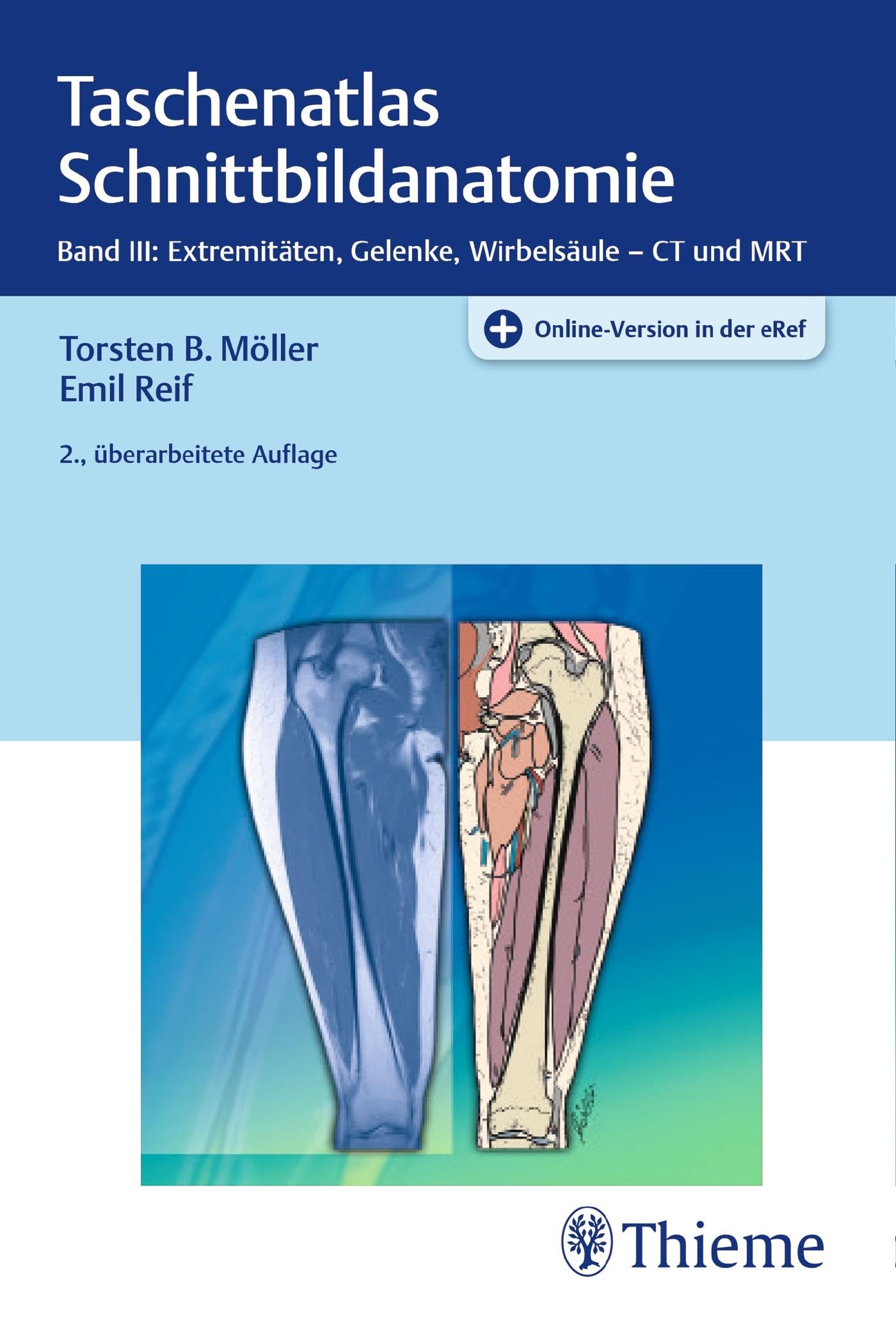 Taschenatlas Schnittbildanatomie: Band III: Extremitäten, Gelenke, Wirbelsäule Medicine