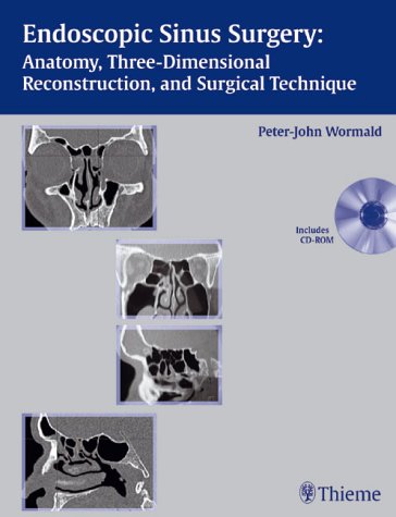 Endoscopic Sinus Surgery (incl. CD-ROM): Anatomy, Thee-Dimensional Reconstruction, and Surgical Technique: Anatomy, Three-dimensional Reconstruction, and Surgical Technique Medicine