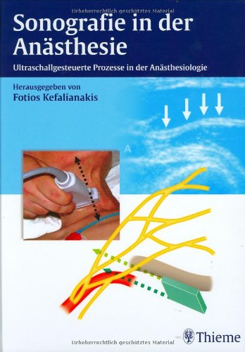 Sonografie (sic!) in der Anästhesie: Ultraschallgesteuerte Prozesse in der Anästhesiologie Medicine