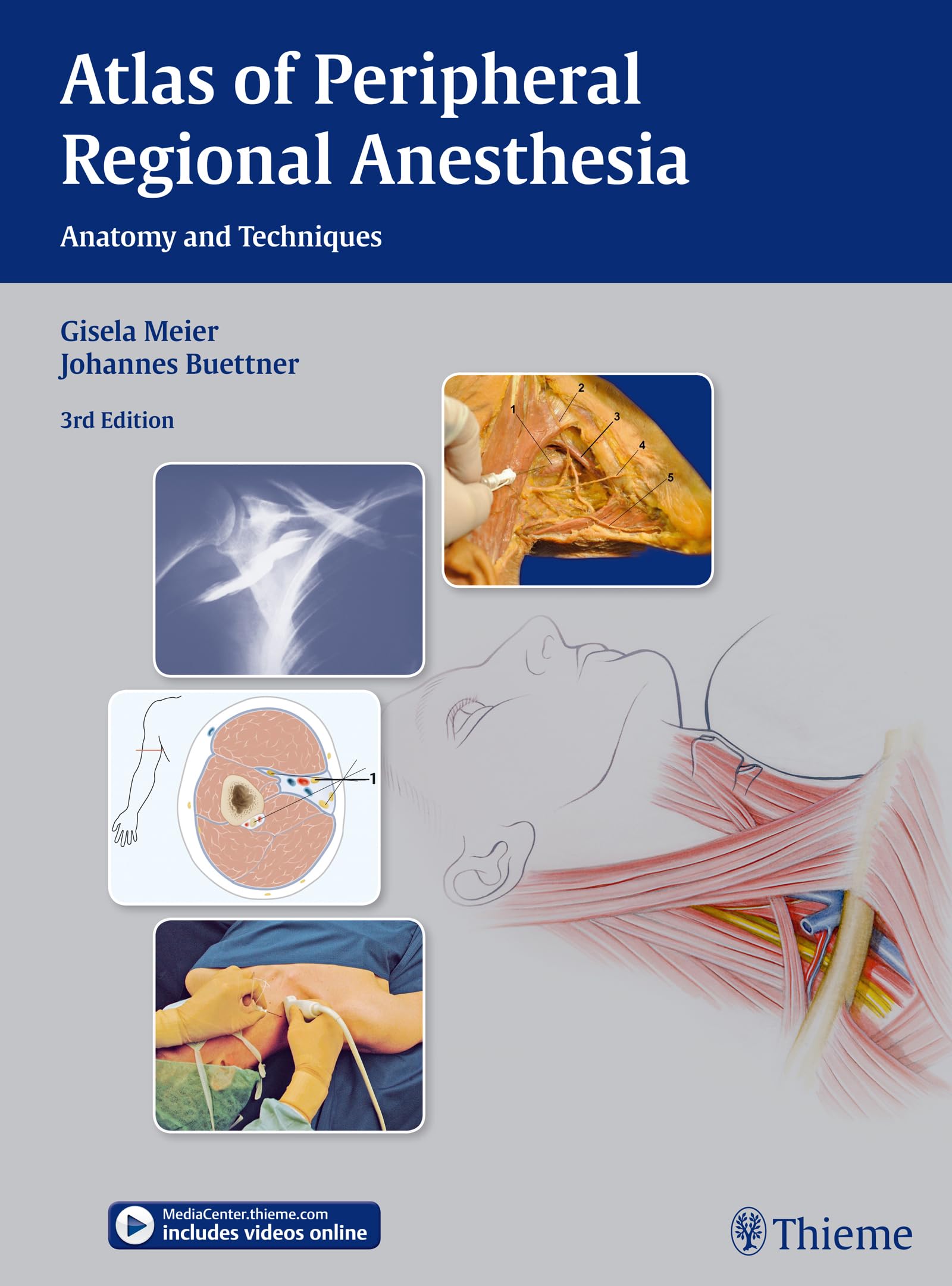 Atlas of Peripheral Regional Anesthesia: Anatomy and Techniques Medicine