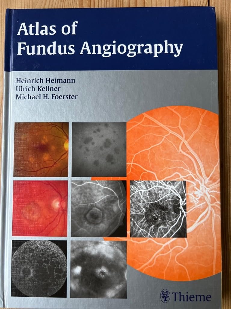 Atlas of Fundus Angiography Medicine