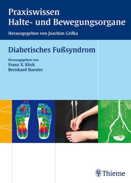 Diabetisches Fußsyndrom (Reihe, Praxisw. Halte-Bew.) Medicine