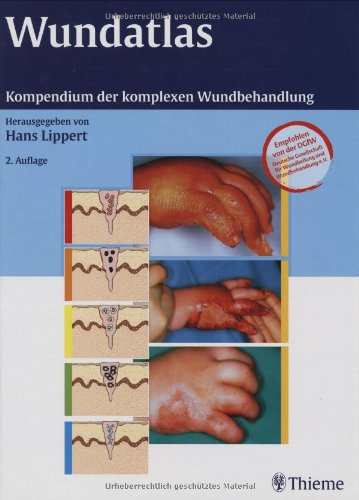 Wundatlas: Kompendium der komplexen Wundbehandlung Medicine