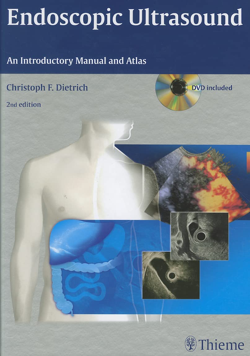 Endoscopic Ultrasound: An Introductory Manual and Atlas Medicine
