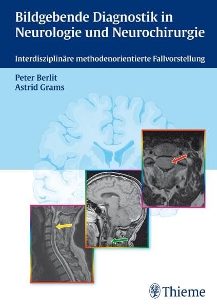 Bildgebende Diagnostik in Neurologie und Neurochirurgie: Interdisziplinäre methodenorientierte Fallvorstellung: Interdisziplinäre methodenorientierte Falldarstellung Medicine