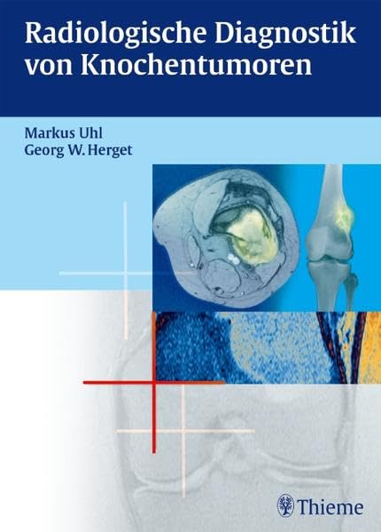 Radiologische Diagnostik von Knochentumoren Medicine