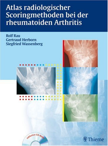 Atlas radiologischer Scoringmethoden bei der rheumatoiden Arthritis Medicine