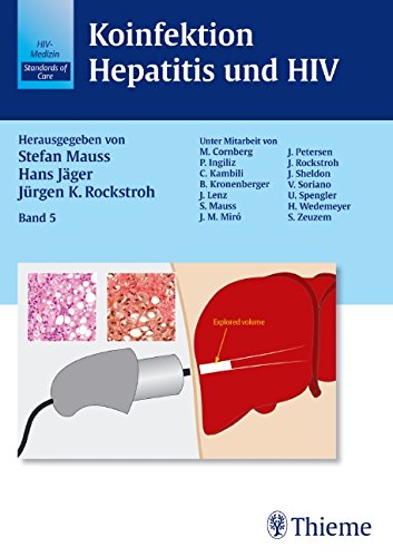 Koinfektion Hepatitis und HIV (Thieme) / Koinfektion Hepatitis und HIV (Bd. 5) Medicine