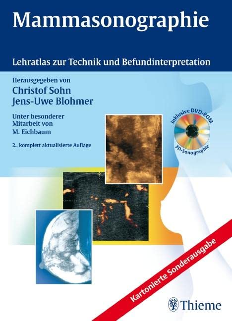 Mammasonographie: Lehratlas zur Technik und Befundinterpretation Medicine