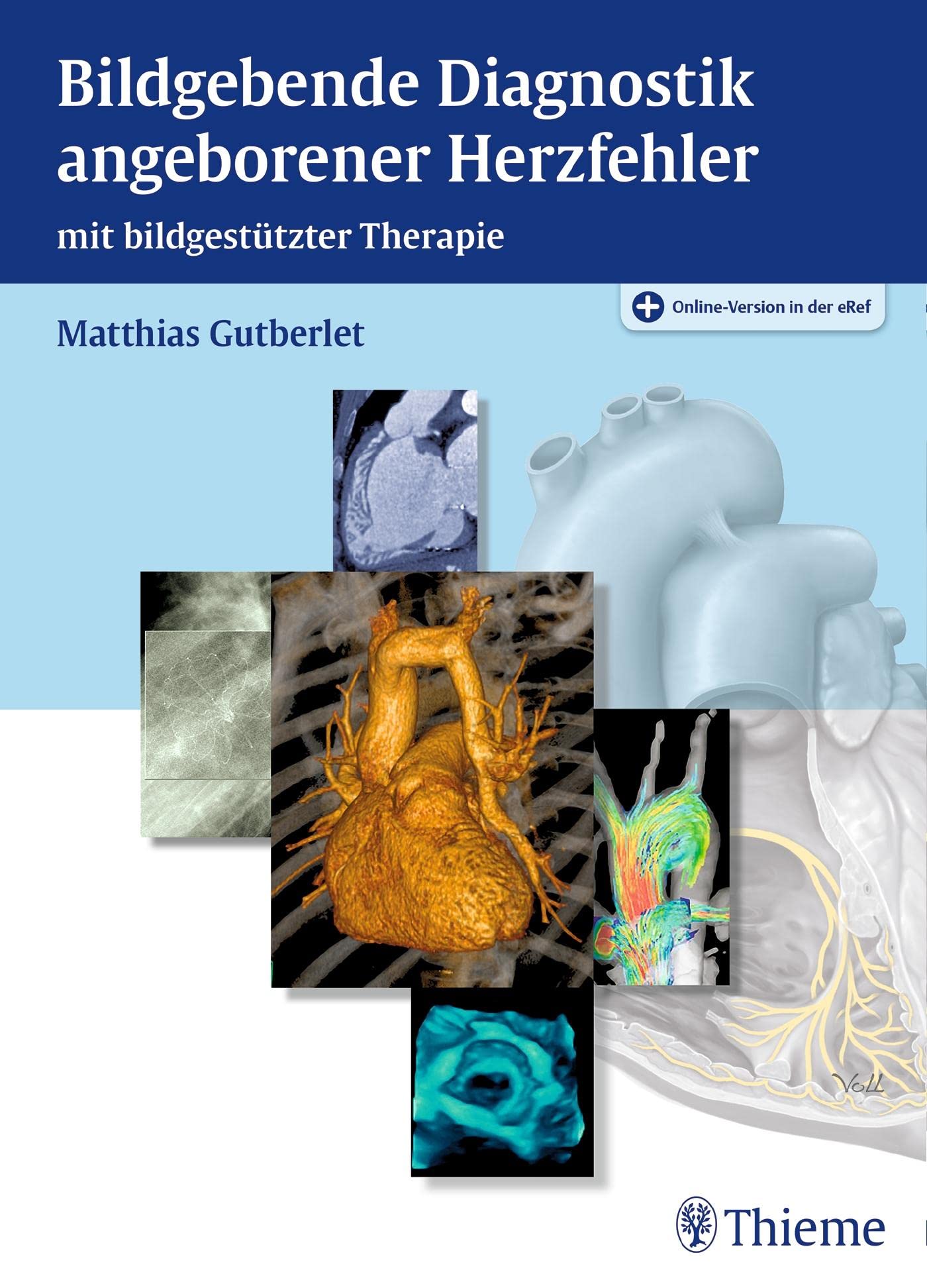 Bildgebende Diagnostik angeborener Herzfehler Medicine