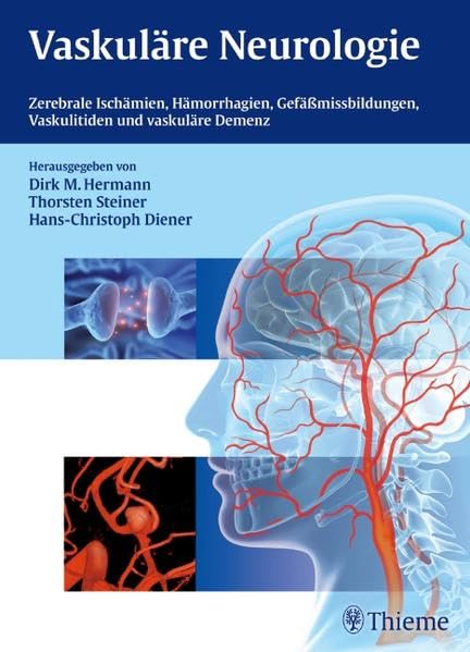 Vaskuläre Neurologie Medicine