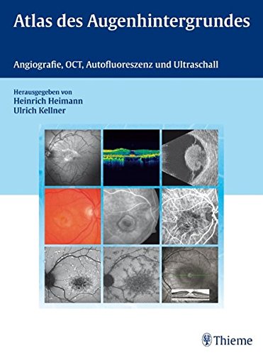 Atlas des Augenhintergrundes: Angiografie, OCT, Autofluoreszenz und Ultraschall Medicine