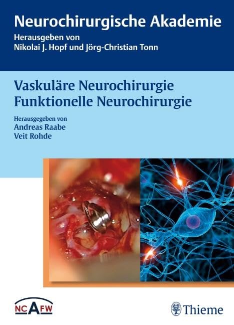 Vaskuläre Neurochirurgie Funktionelle Neurochirurgie (Neurochirurgische Akademie) Medicine