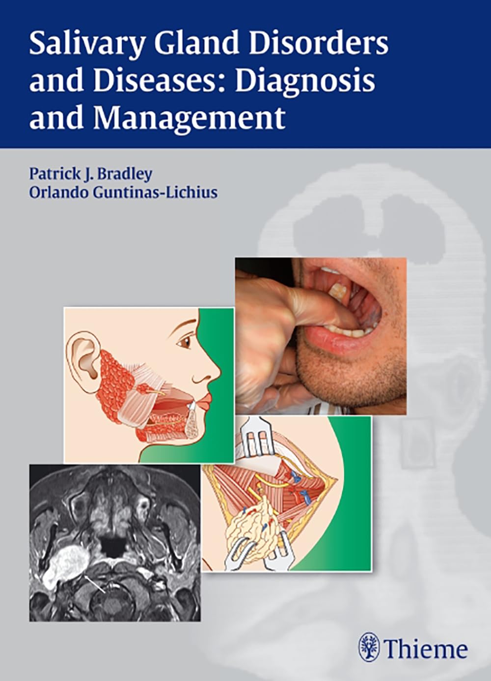 Salivary Gland Disorders and Diseases:: Diagnosis and Management Medicine