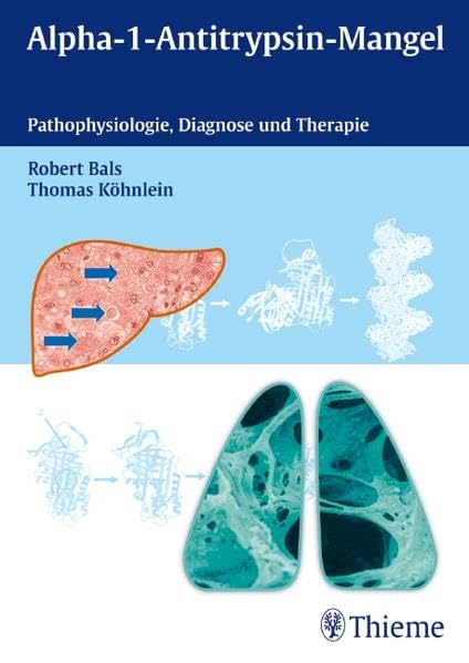Alpha-1-Antitrypsin-Mangel: Pathophysiologie, Diagnose und Therapie Medicine