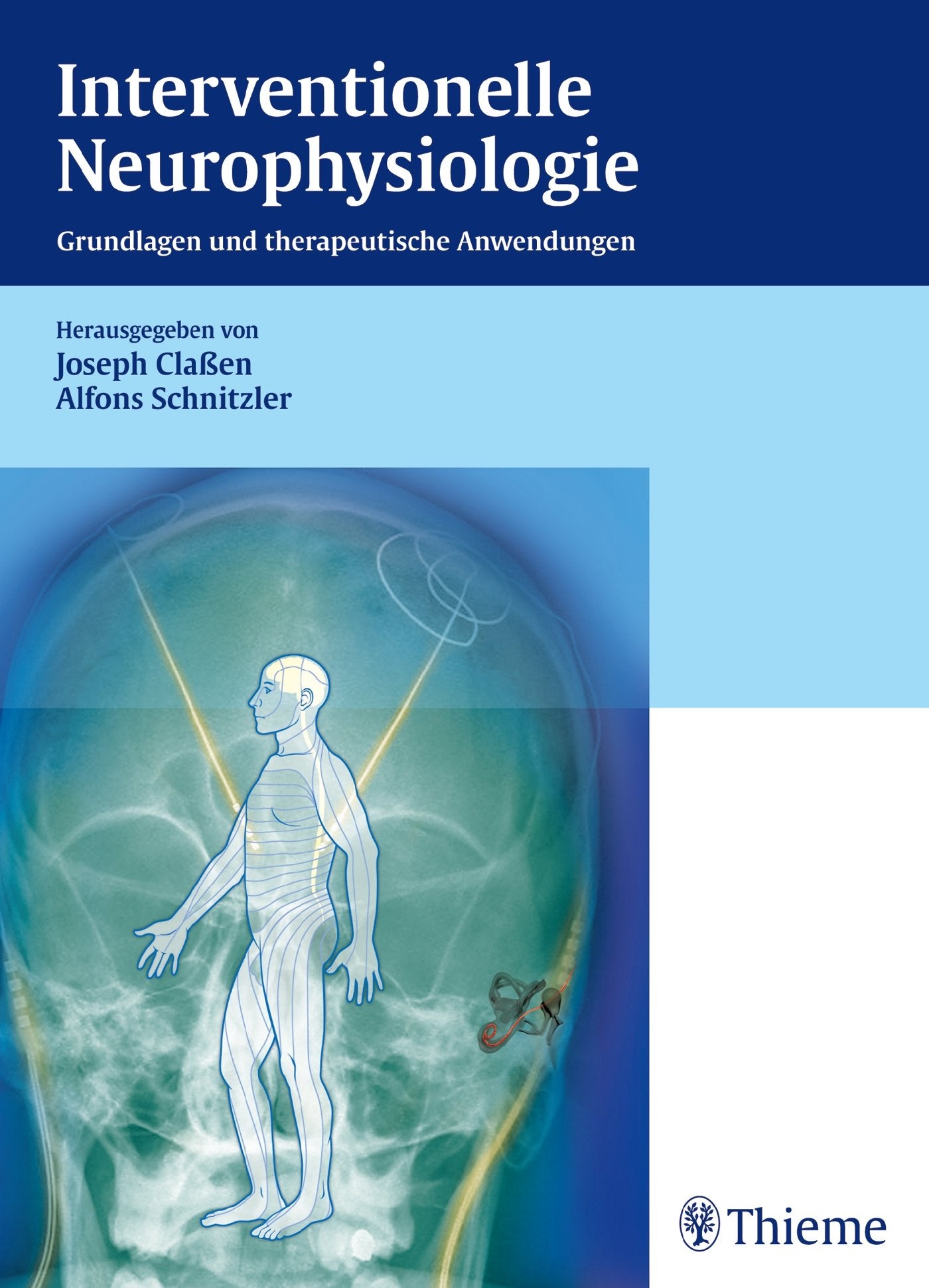Interventionelle Neurophysiologie: Grundlagen und therapeutische Anwendungen Medicine