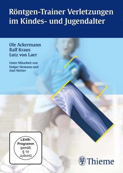 Röntgen-Trainer Verletzungen im Kindes- und Jugendalter Medicine