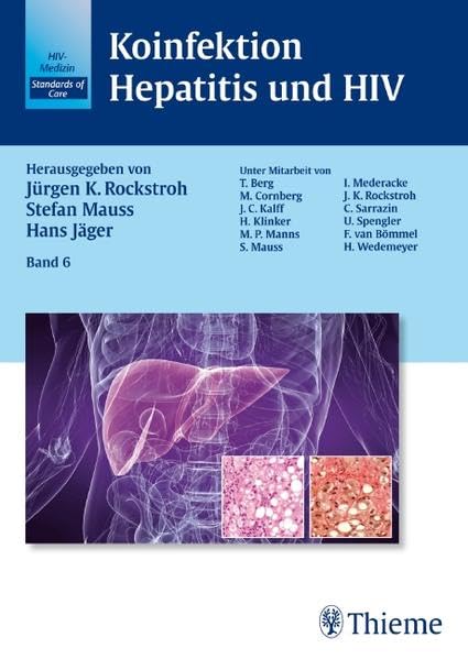 Koinfektion Hepatitis und HIV: Band 6 Medicine