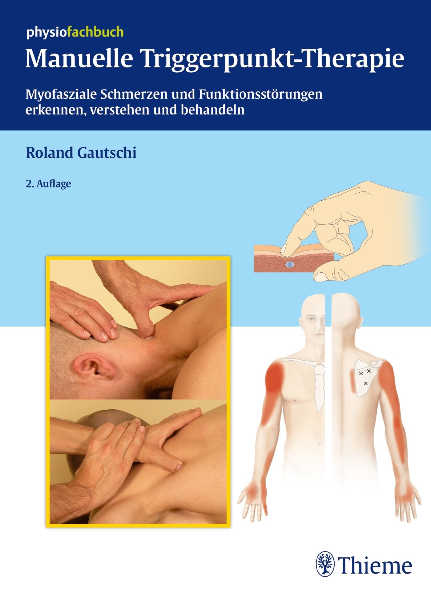 Manuelle Triggerpunkt-Therapie: Myofasziale Schmerzen und Funktionsstörungen erkennen, verstehen und behandeln (REIHE, physiofachbuch) Medicine