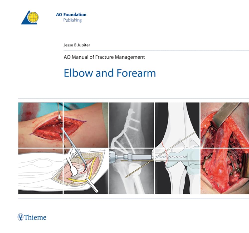 AO Manual of Fracture Management - Elbow & Forearm: Elbow and Forearm (AO-Publishing) Medicine