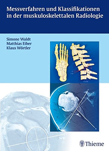 Messverfahren und Klassifikationen in der muskuloskelettalen Radiologie Medicine