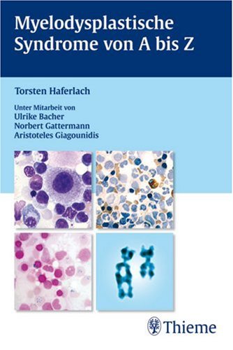 Myelodysplastische Syndrome von A bis Z Medicine