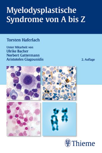 Myelodysplastische Syndrome von A bis Z Medicine