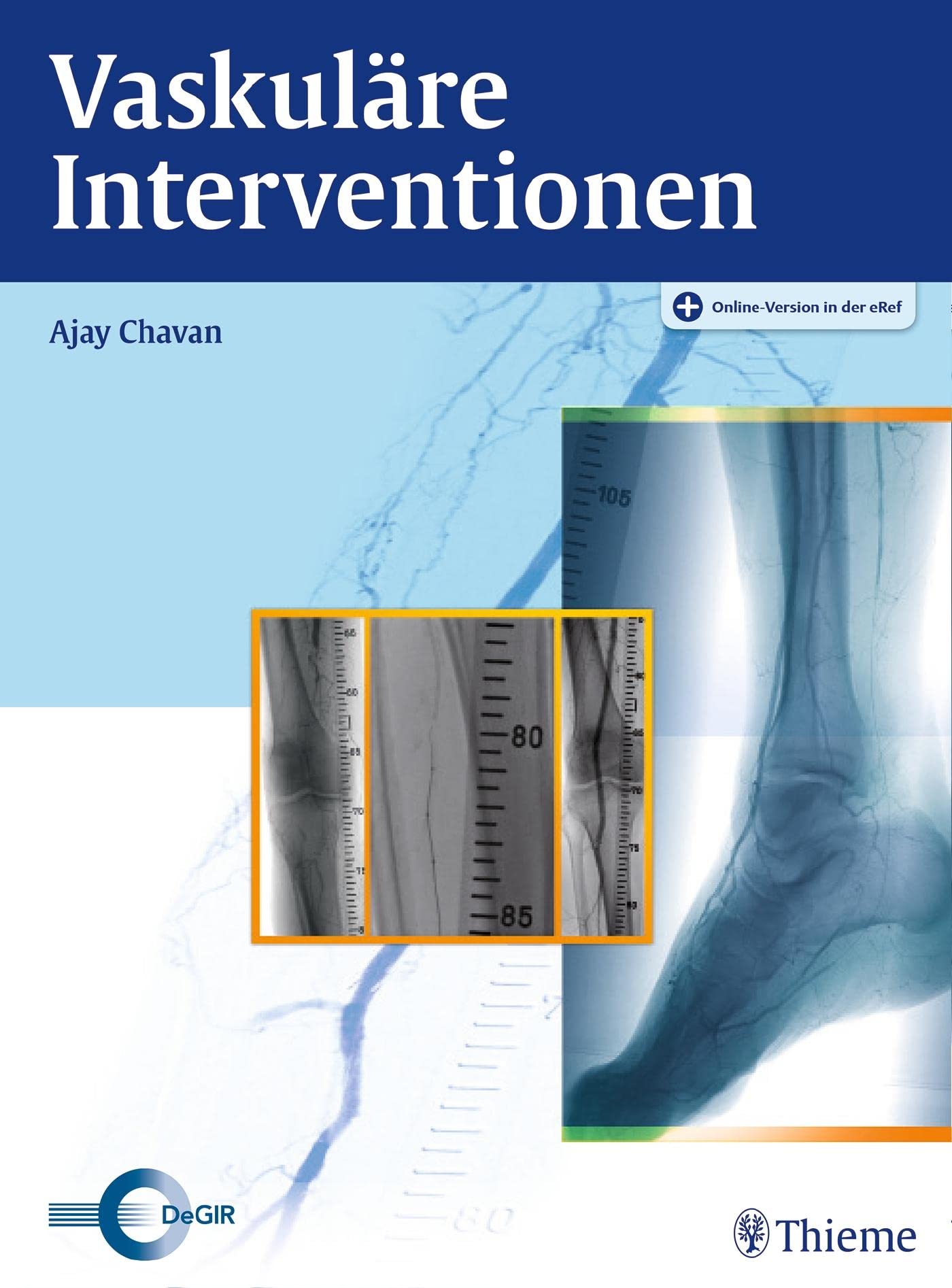 Vaskuläre Interventionen Medicine