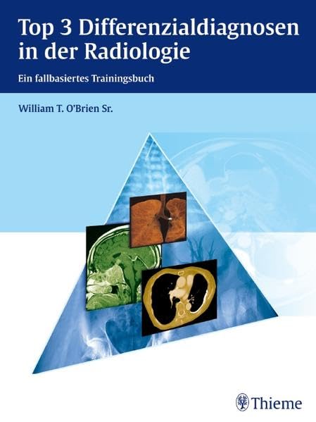 Top 3 Differenzialdiagnosen in der Radiologie: Ein fallbasiertes Trainingsbuch book