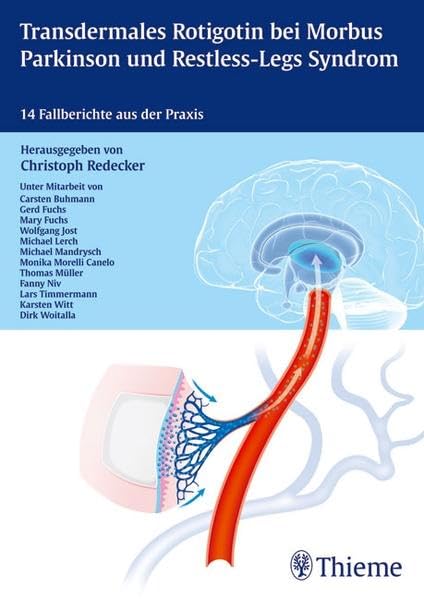 Kasuistikbuch Rotigotin: 14 Fallberichte aus der Praxis Medicine