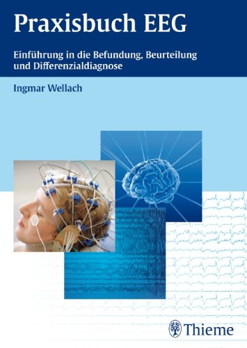Praxisbuch EEG: Einführung in die Befundung, Beurteilung und Differenzialdiagnose Medicine
