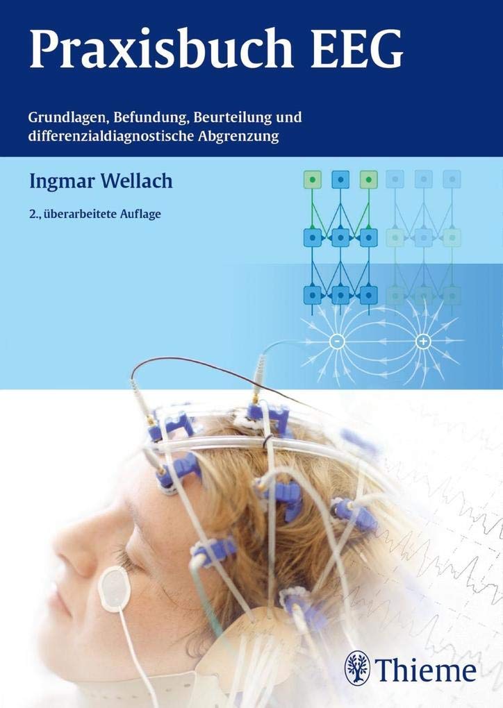 Praxisbuch EEG: Grundlagen, Befundung, Beurteilung und differenzialdiagnostische Abgrenzung Medicine