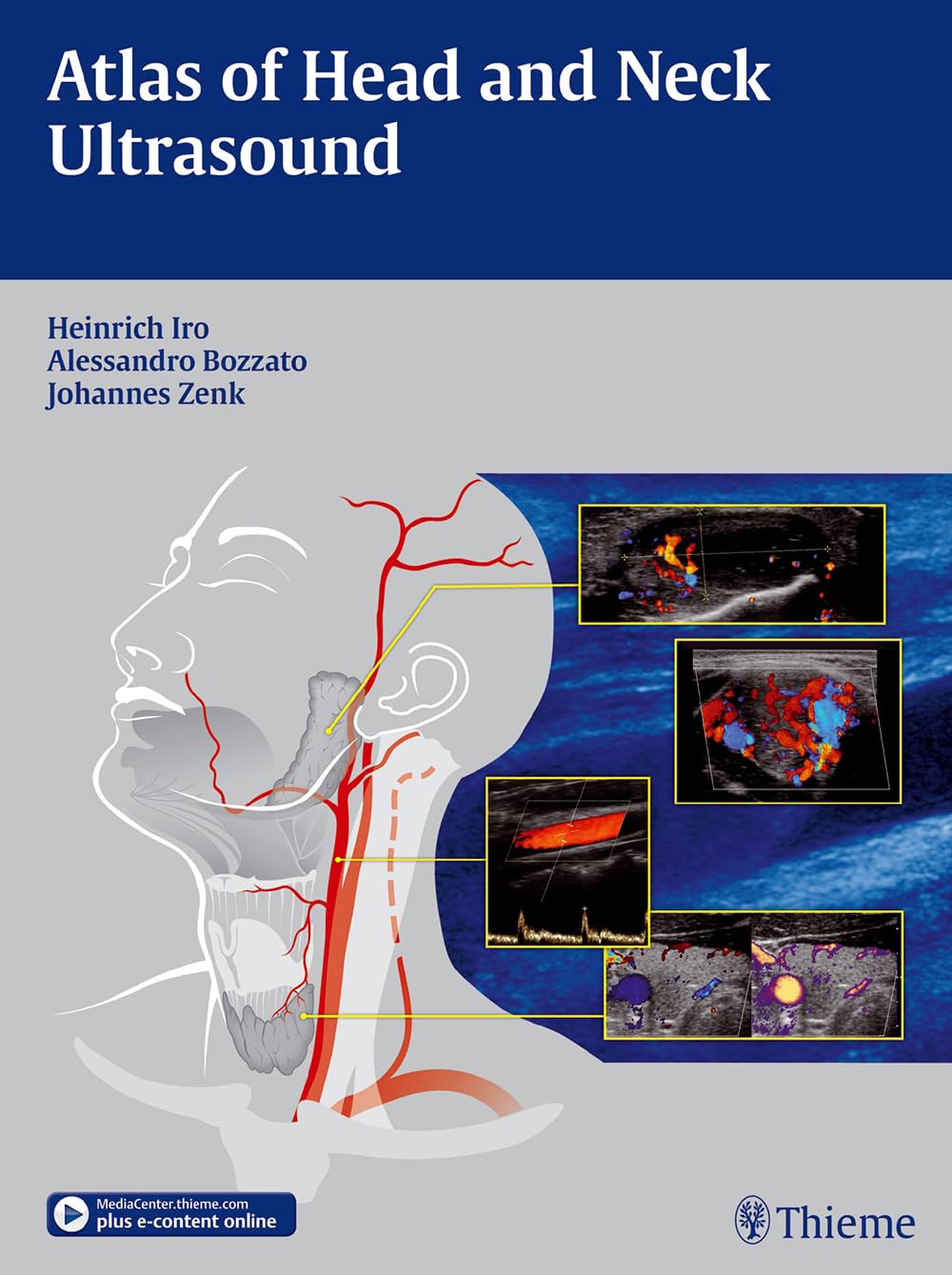 Atlas of Head and Neck Ultrasound Medicine