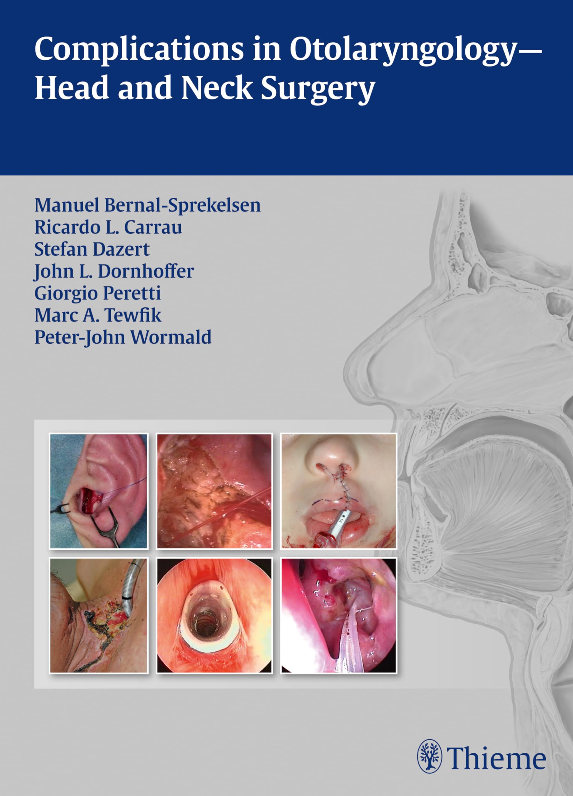 Complications in Otolaryngology-Head and Neck Surgery book
