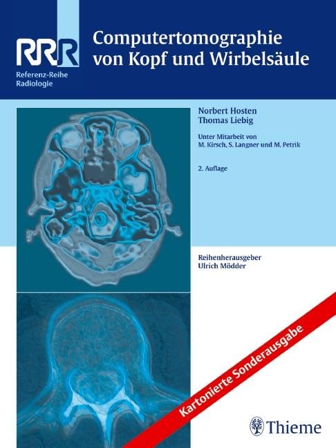 Computertomographie von Kopf und Wirbelsäule (Referenz-Reihe Radiologie) Medicine